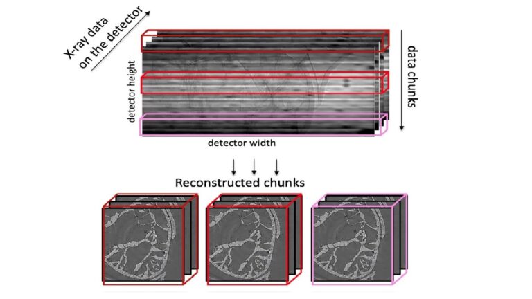Un scientifique développe une nouvelle méthode de reconstruction des données par rayons X

