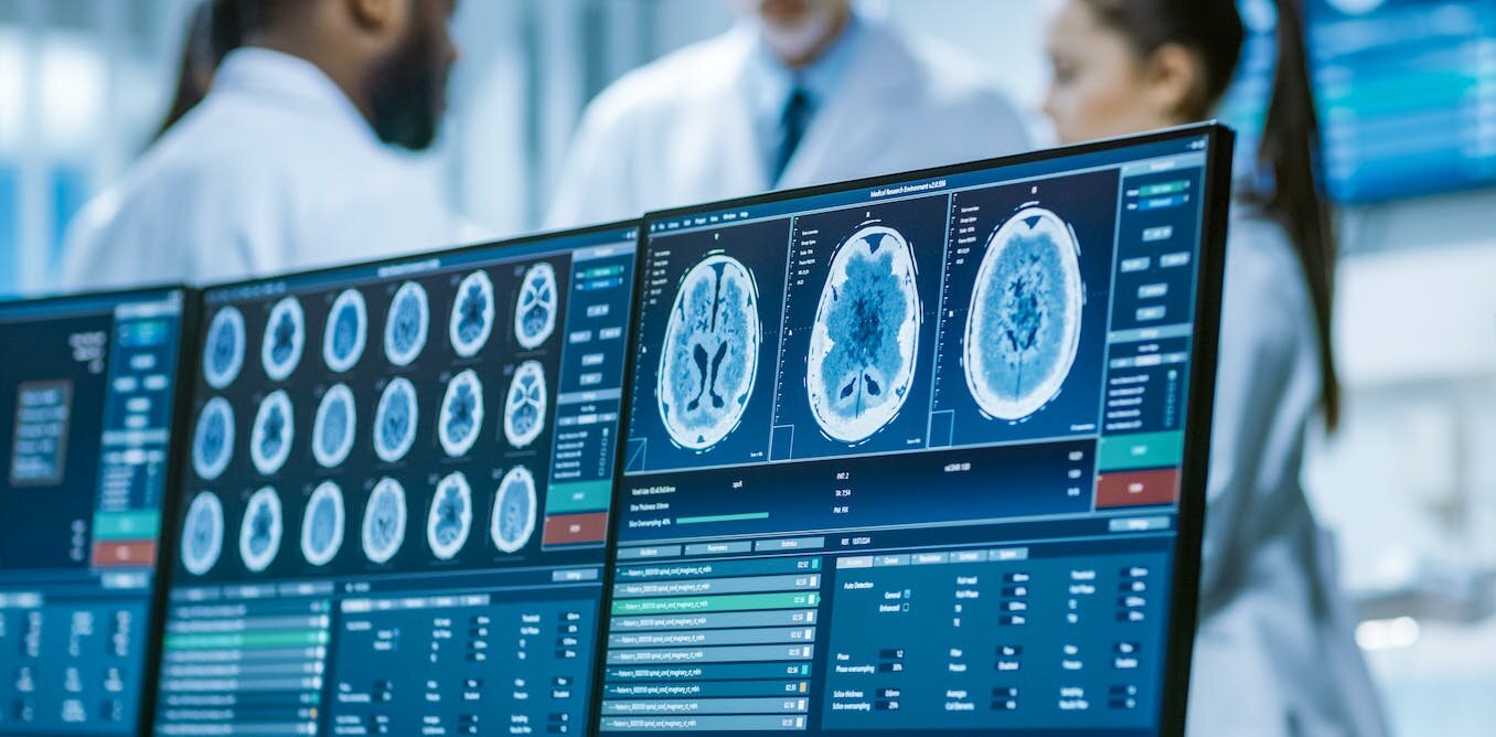 Les scans IRM et la technologie de l'IA pourraient vraiment lire ce que nous pensons.  Les implications sont terrifiantes
