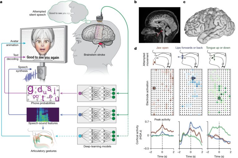Une interface cerveau-ordinateur permet à une femme gravement paralysée de parler via un avatar numérique
