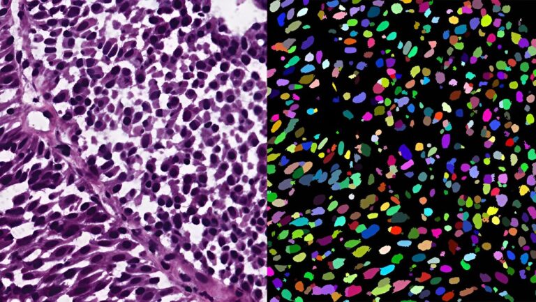 Segmentation d'images de microscopie via la synthèse de données régularisées de points et de formes
