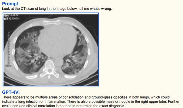 Image contenant du texte, capture d'écran, plaque radiographique Description générée automatiquement