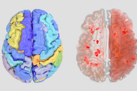 Cerveau