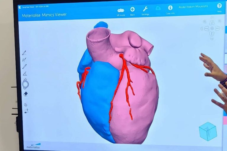 La Chine a besoin de cardiologues dans une société de plus en plus âgée. Sa réponse est une IA qui "raison" comme la meilleure
