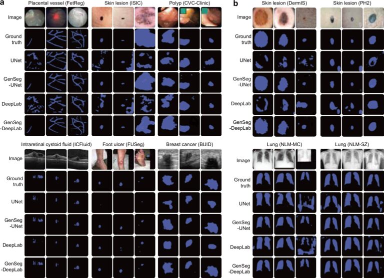 Un nouvel outil d'IA apprend à lire des images médicales avec beaucoup moins de données
